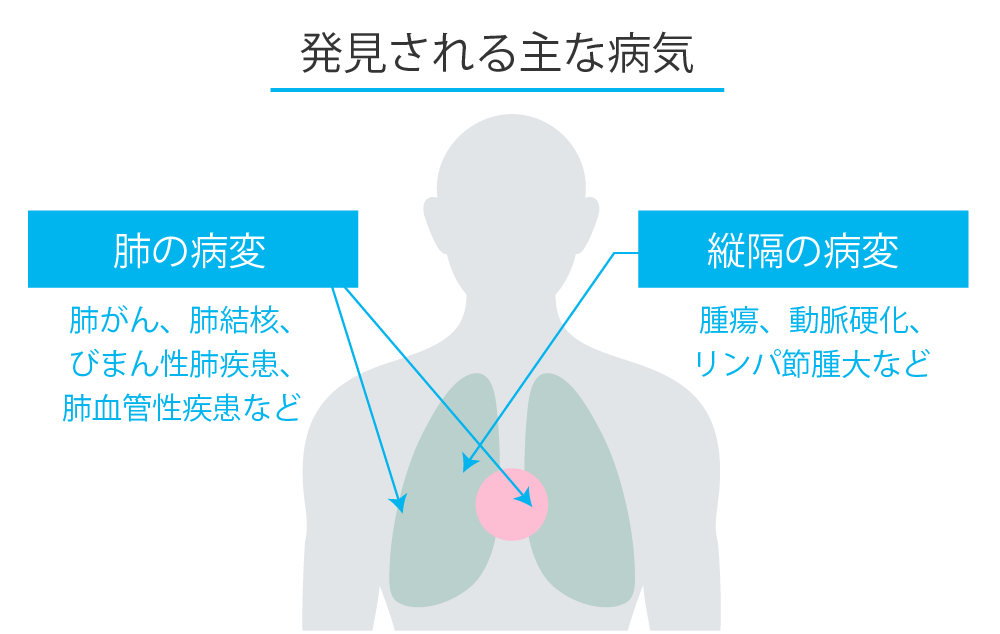 発見される主な病気