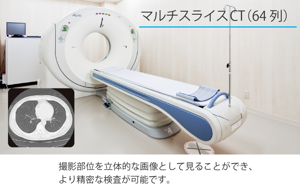 マルチスライスCT(64列)