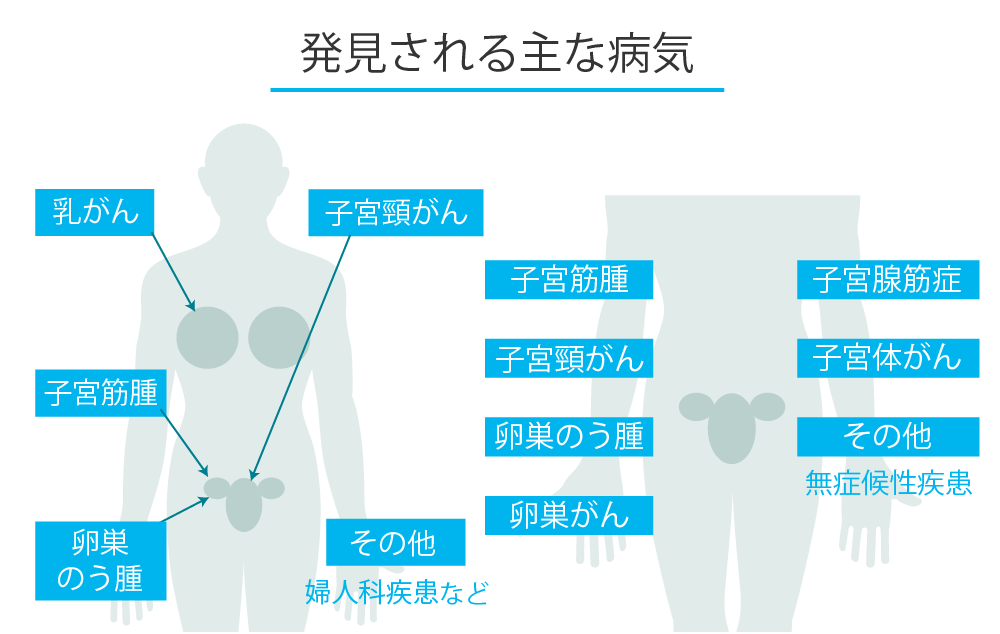 発見される主な病気